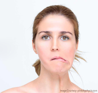 Bells-palsy-1 Bells-palsy-1